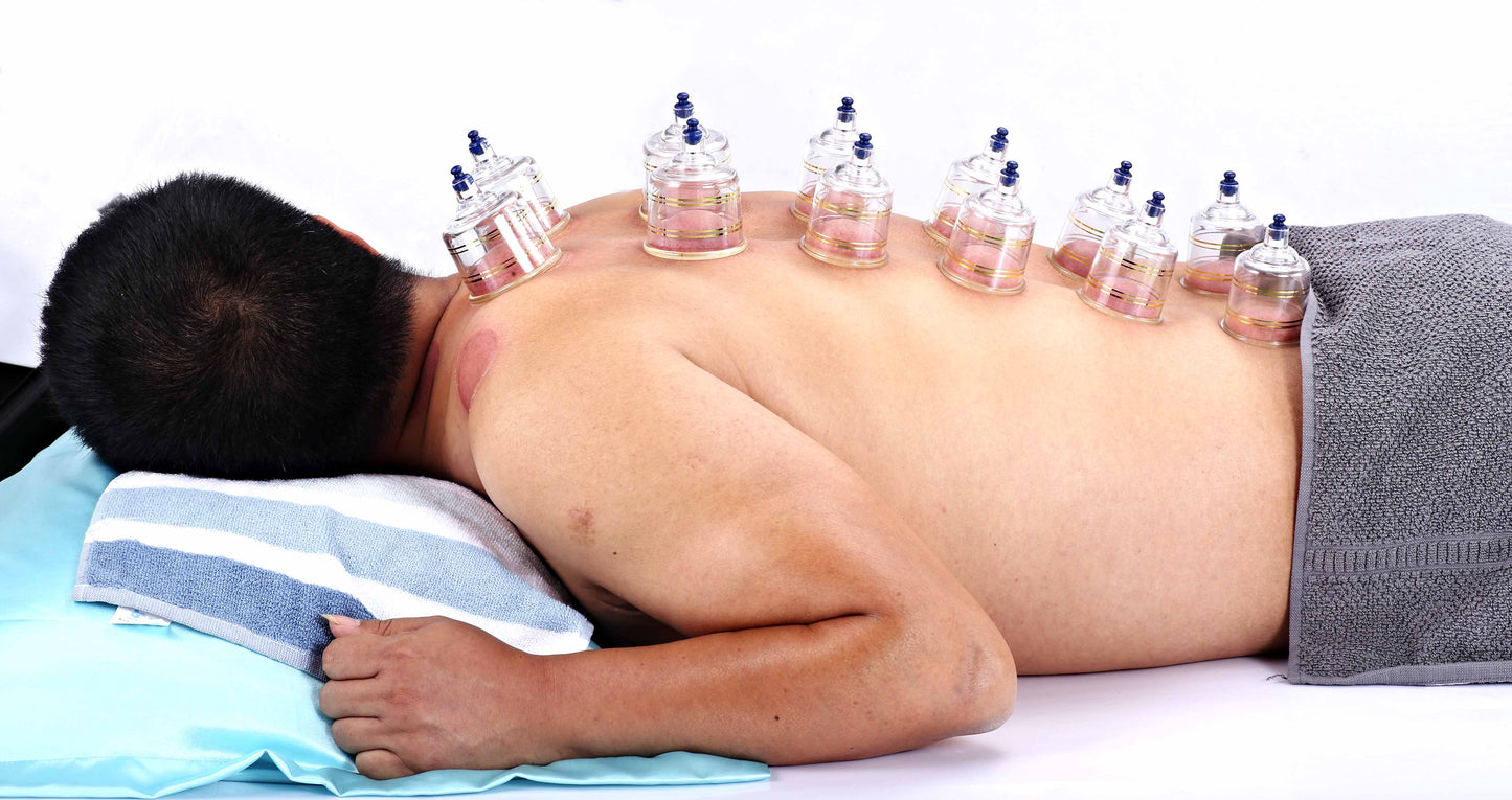 AcuTop® cupping set, 19-delig